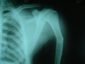 coimbatore-orthopaedic-joint-replacement-maternity-child-welfare-centre-india