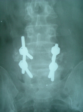 coimbatore-orthopaedic-joint-replacement-maternity-child-welfare-centre-india