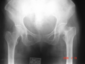 coimbatore-orthopaedic-joint-replacement-maternity-child-welfare-centre-india